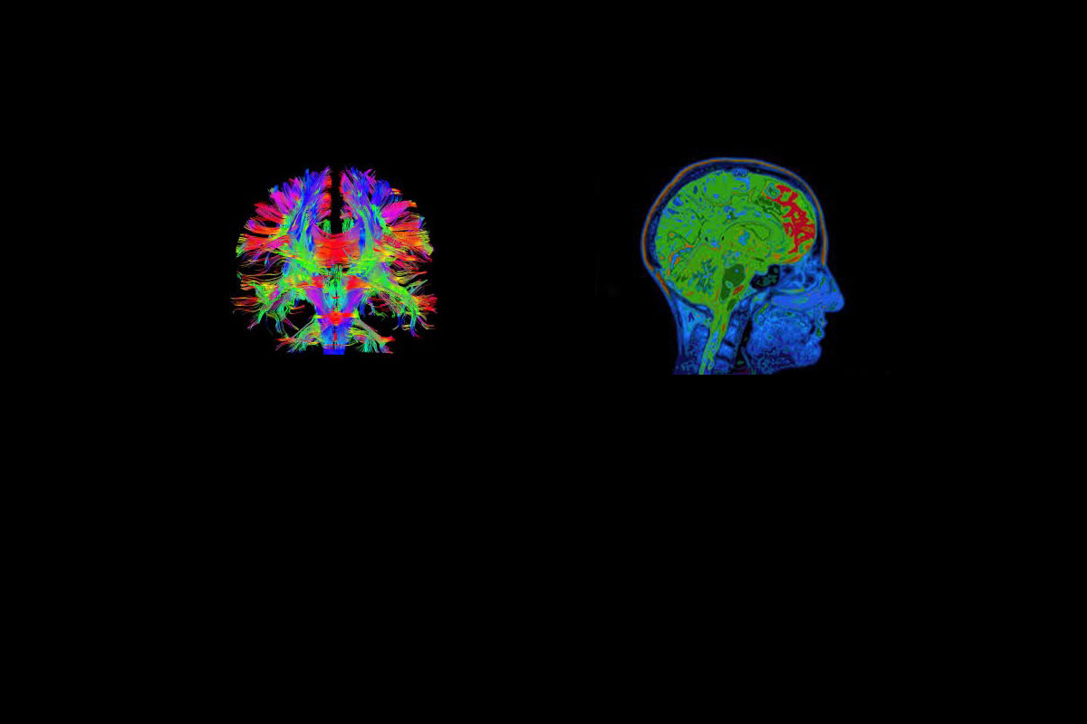 Adolescent Neuroscience and Online Safety